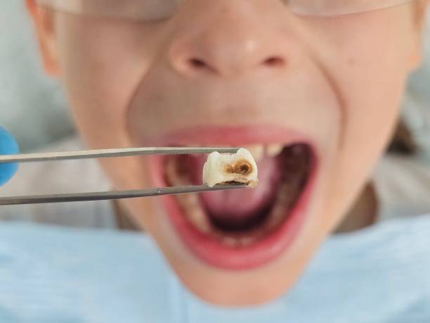 Best Broken Tooth Emergency  in Sand Springs, OK