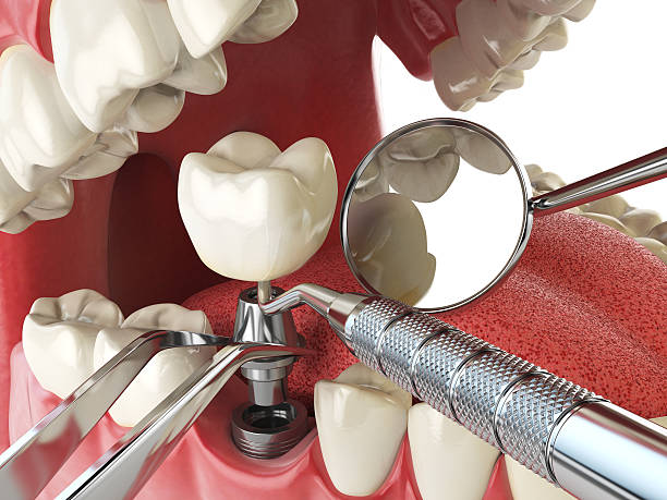 Best Dentist for Dental Trauma  in Sand Springs, OK